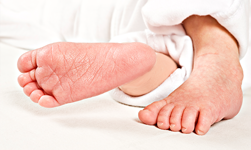 하지불안 주기사지운동장애 이미지